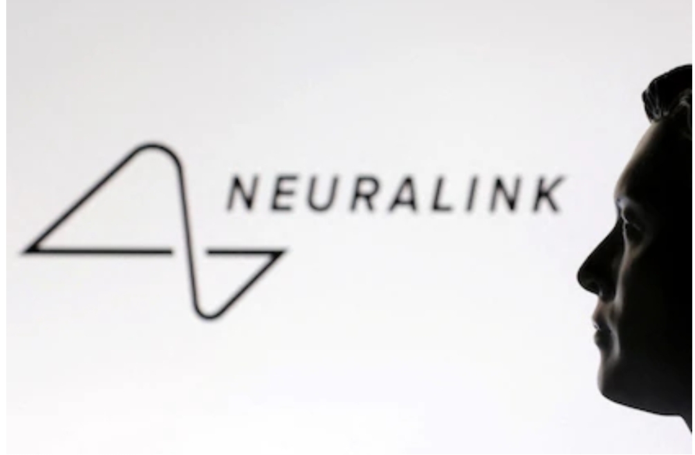 Del cerebro a la voz: cómo los implantes neuronales abren un nuevo camino para la autonomía